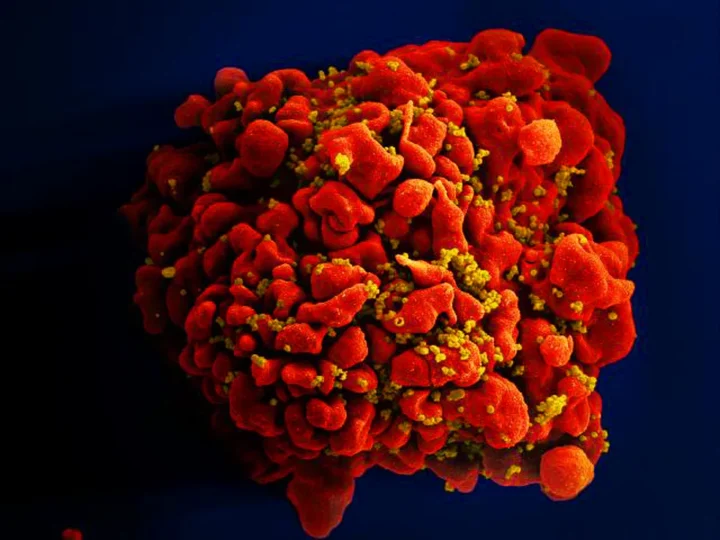 HIV: dois novos casos de cura são anunciados; total chega a 13