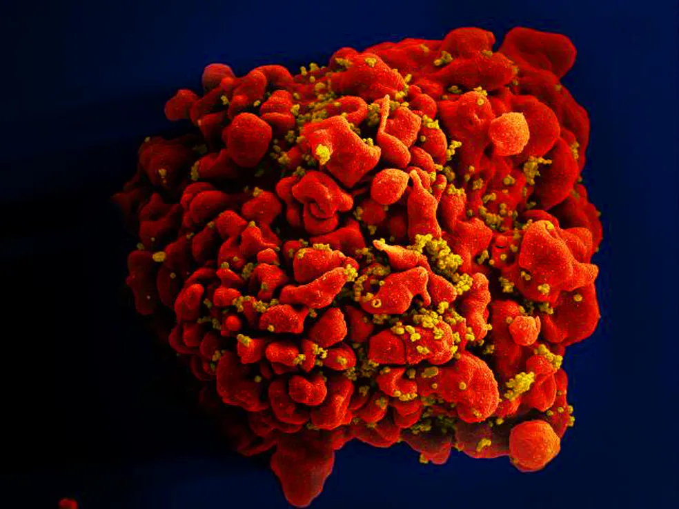 HIV: dois novos casos de cura são anunciados; total chega a 13